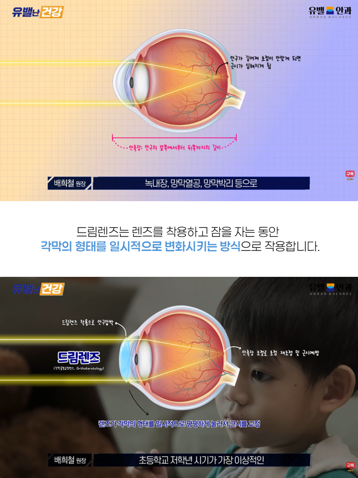 인천드림렌즈 4