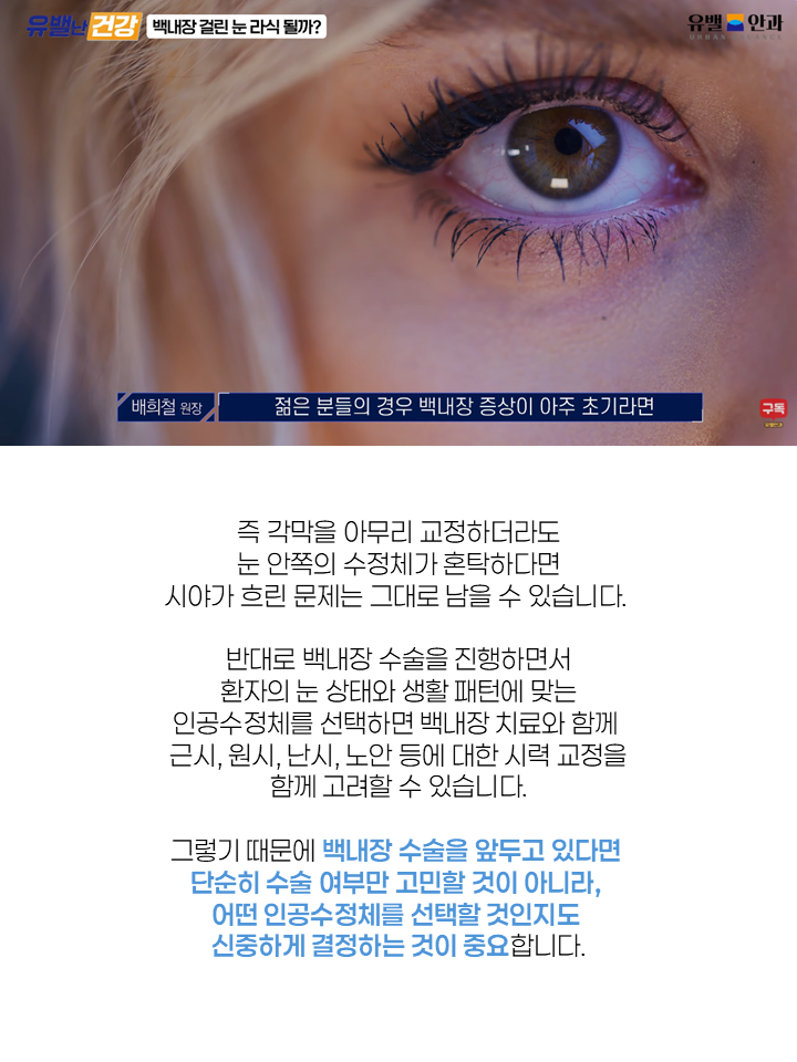 인천백내장수술 10