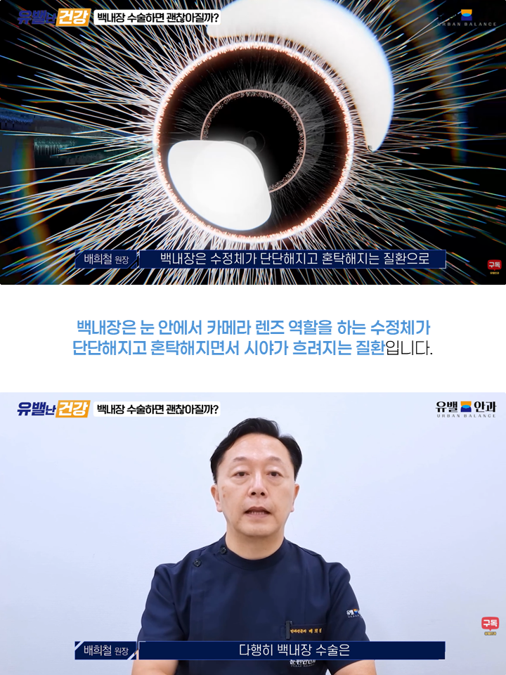 인천백내장수술 3